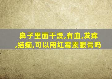 鼻子里面干燥,有血,发痒,结痂,可以用红霉素眼膏吗