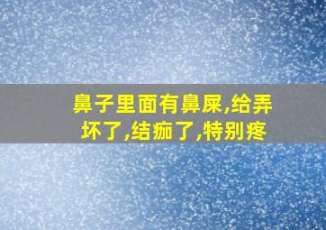 鼻子里面有鼻屎,给弄坏了,结痂了,特别疼