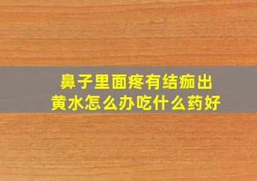 鼻子里面疼有结痂出黄水怎么办吃什么药好