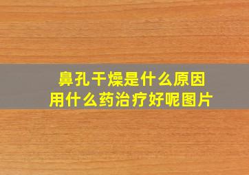 鼻孔干燥是什么原因用什么药治疗好呢图片