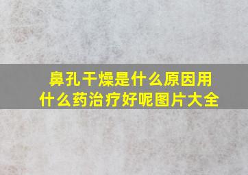 鼻孔干燥是什么原因用什么药治疗好呢图片大全