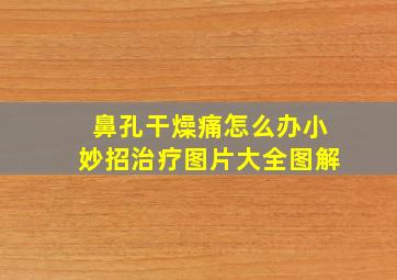 鼻孔干燥痛怎么办小妙招治疗图片大全图解