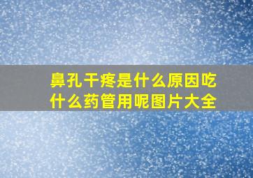 鼻孔干疼是什么原因吃什么药管用呢图片大全