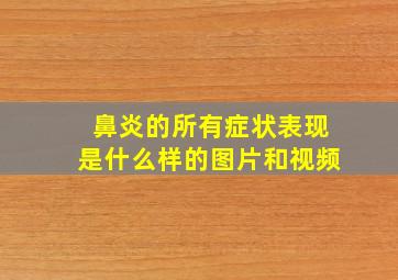 鼻炎的所有症状表现是什么样的图片和视频