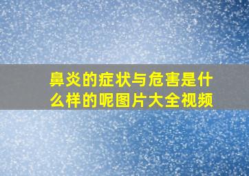 鼻炎的症状与危害是什么样的呢图片大全视频