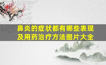 鼻炎的症状都有哪些表现及用药治疗方法图片大全