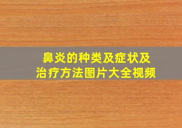 鼻炎的种类及症状及治疗方法图片大全视频